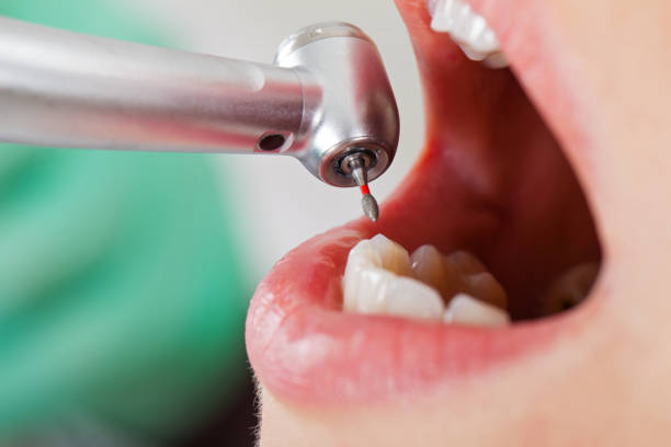 Best Emergency Gum Treatment in Fairview, TX